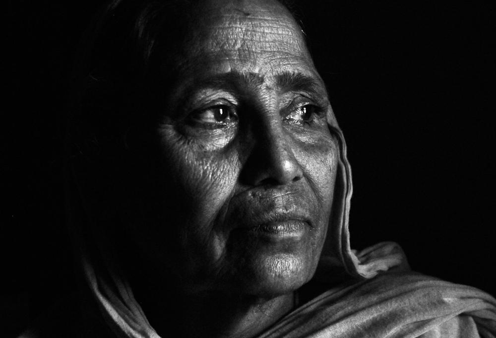 বুন্নি বেগম-এর দু হাতে আটটি আঙুল। ২৬ অক্টোবর, ১৯৮৯ যাদের তরোয়ালের কোপ ঠেকাতে আঙুল দুটো গেছে, তারা সকলেই চেনা। কিন্তু কখনও তাদের নাম বলেননি বুন্নি বেগম।বুন্নি বেগমের দিদিরা মরেই গিয়েছিল। আর বুন্নি বেগম মরে গেছে ভেবে, ওরা চলে গিয়েছিল। ছবি সৌজন্য - জাভেদ ইকবাল। Bunni Begum